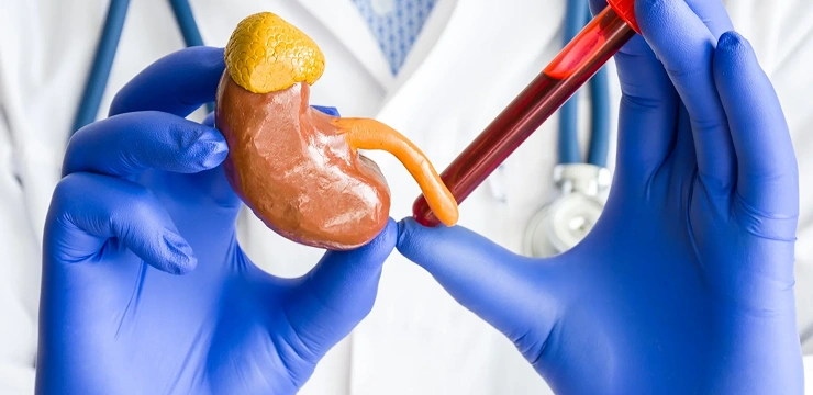 Model of pancreas held by doctor.