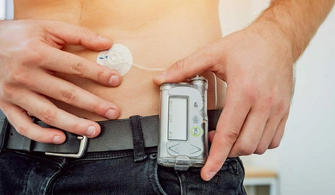 Person using insulin pump on waist.